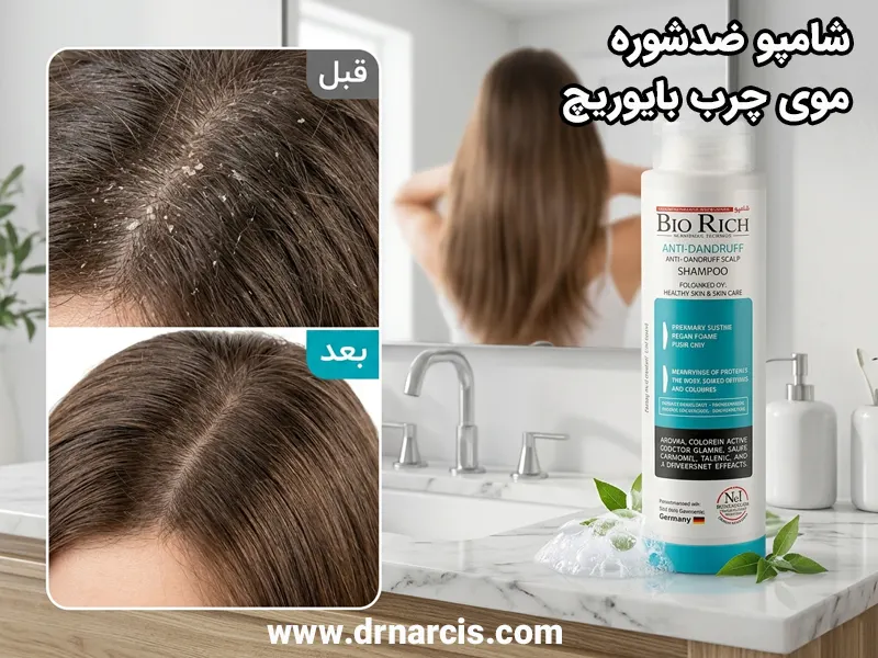 شامپو ضدشوره چرب بایوریچ