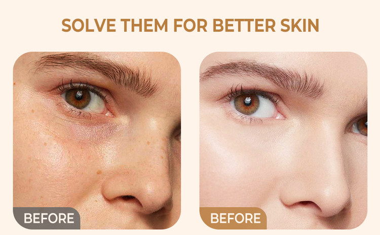 کرم کپسولی ویتامین سی مدیکیوب