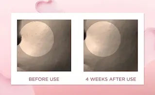 آمپول منافذ سنتلا 