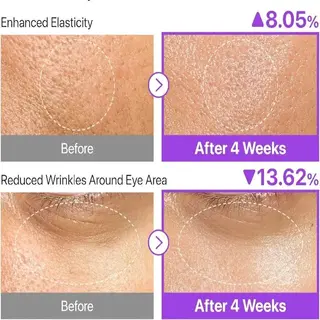 سرم لیفتینگ شماره ۹ نامبوزین 