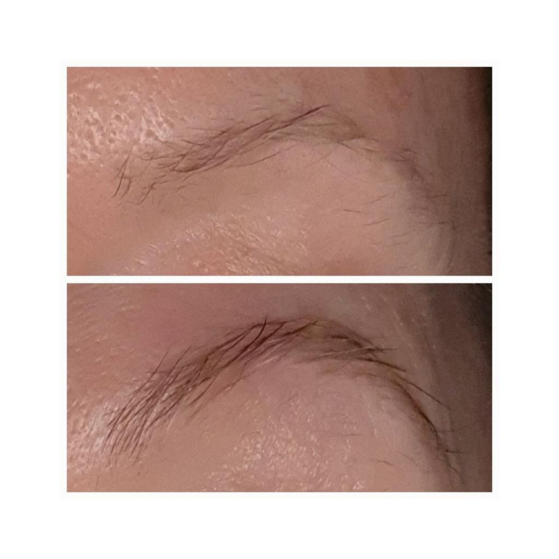 سرم تقویت ابرو ومژه اوردینری