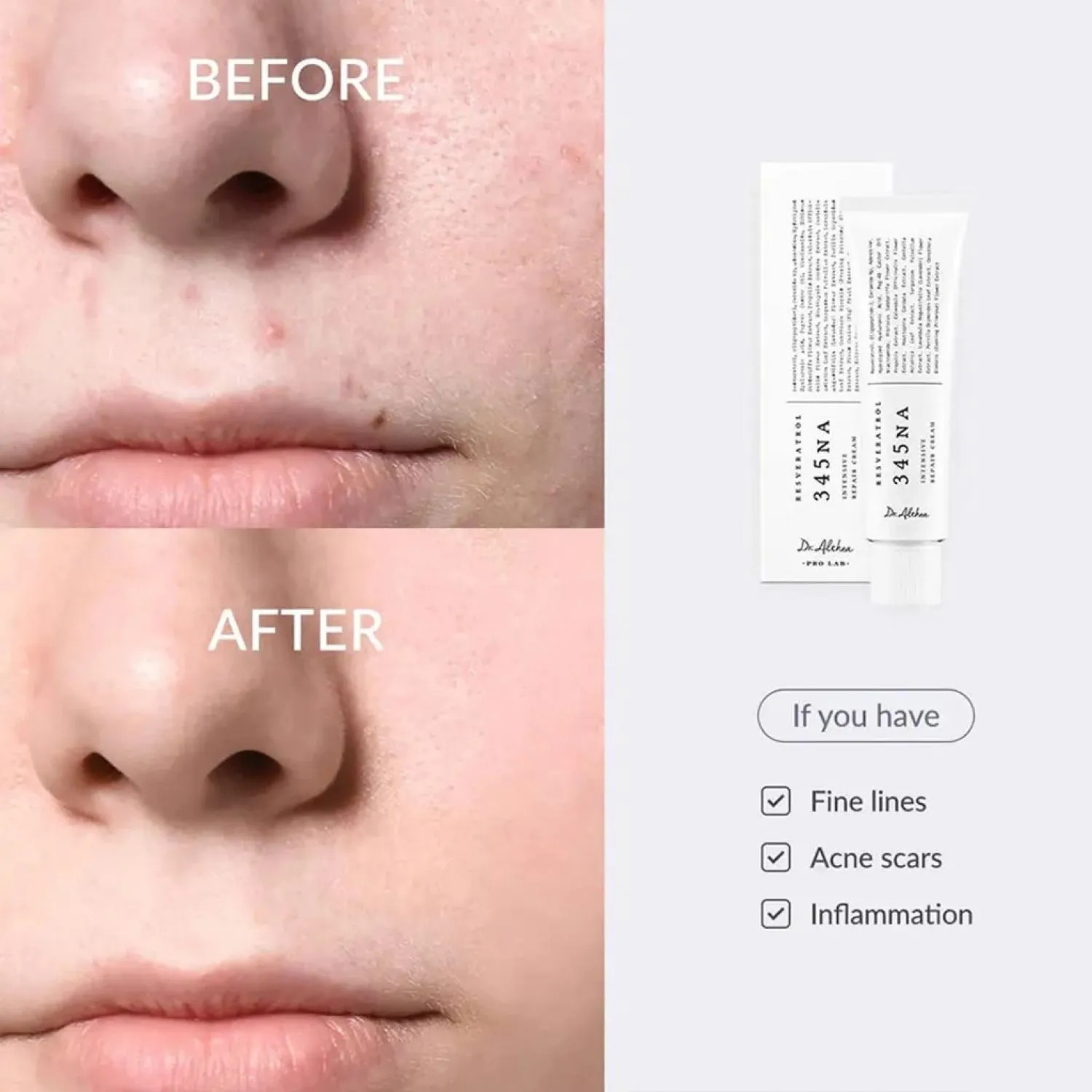 کرم ترمیم کننده دکتر آلتیا 345 | 50 میل